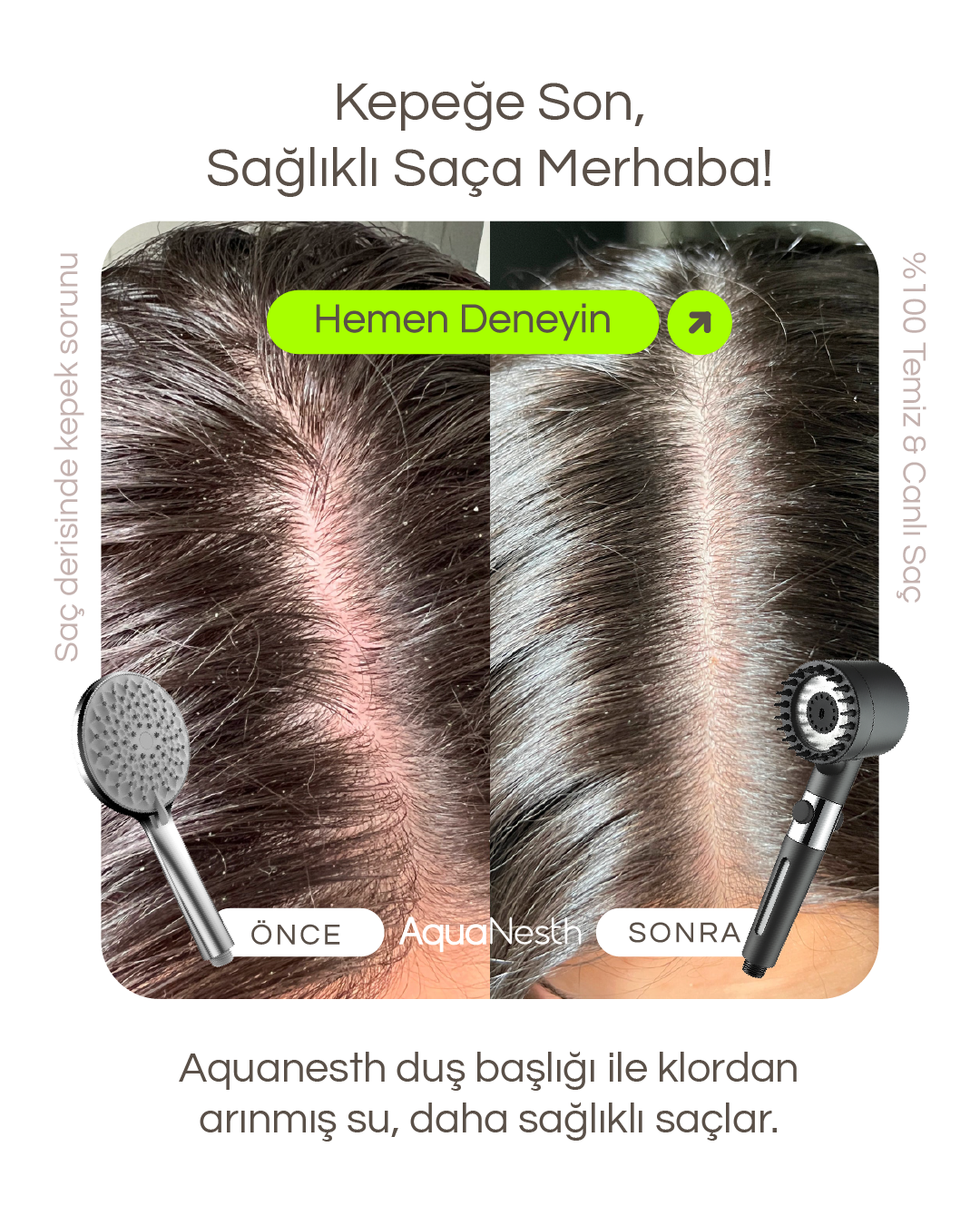 AquaNesth™ Filtreli Duş Başlığı