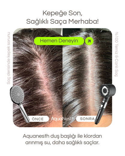 AquaNesth™ Filtreli Duş Başlığı
