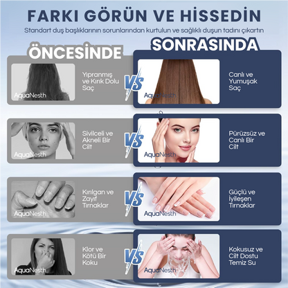AquaNesth™ Filtreli Duş Başlığı