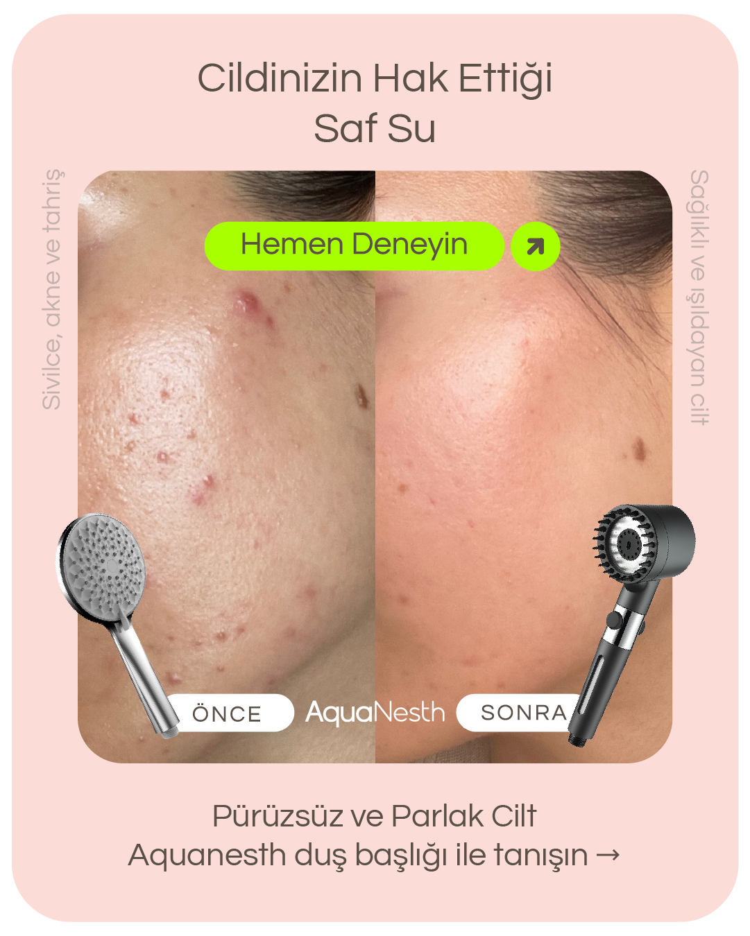 AquaNesth™ Filtreli Duş Başlığı