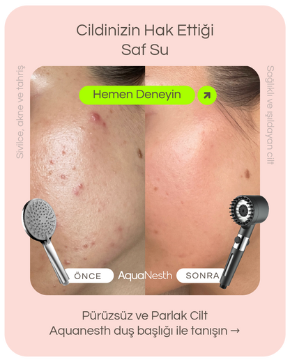 AquaNesth™ Filtreli Duş Başlığı